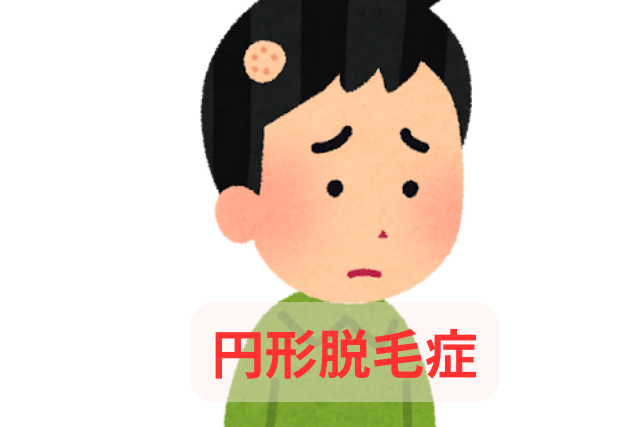 【突然できた円形脱毛症でお悩みの方へ】｜佐賀市開成 恵比寿鍼灸整骨院の鍼灸治療